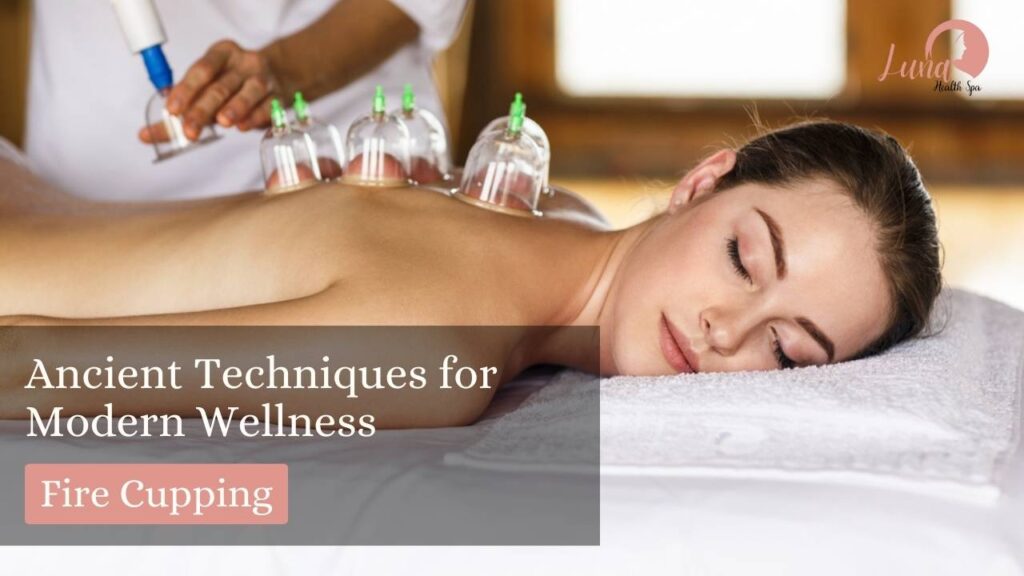 Fire Cupping at Luna Health Spa: Ancient Techniques for Modern Wellness