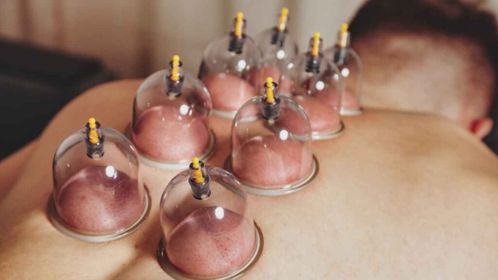 How Fire Cupping Massage Works on the Body